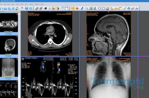 dicom viewer